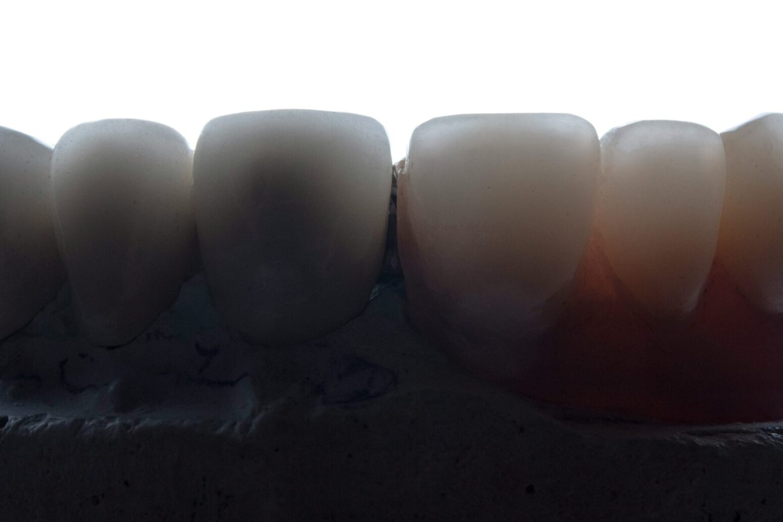 A backlit set of bottom-teeth, as if the camera is in someone's mouth pointing out.